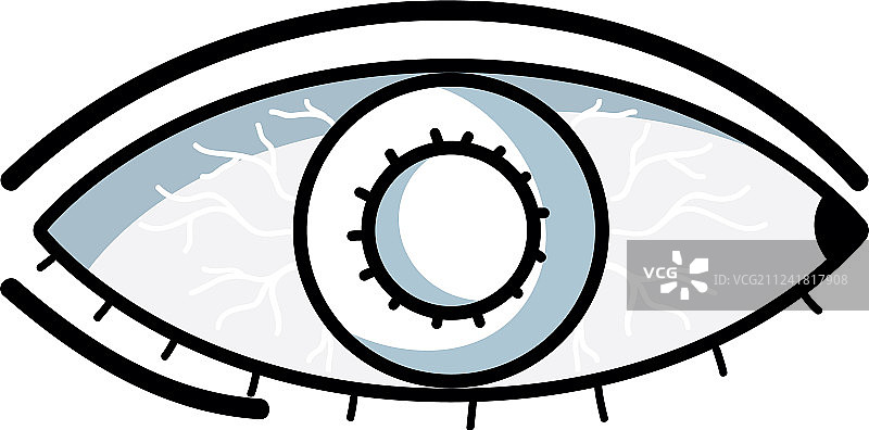 结膜炎图片素材