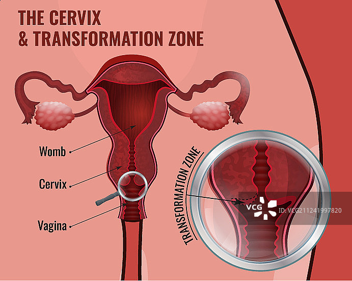 宫颈癌筛查图像图片素材