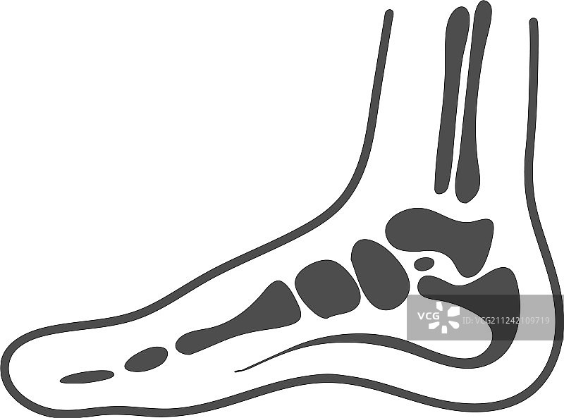 白色背景上孤立的内侧足部解剖图图片素材