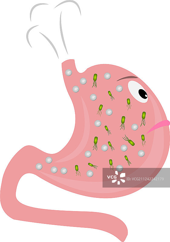 胃胀气和幽门螺杆菌图片素材