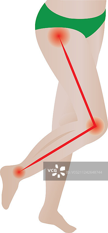 关节痛坐骨神经背痛图片素材