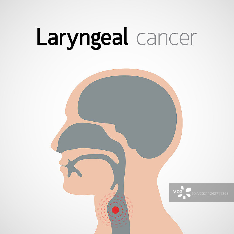 喉癌图标设计图片素材