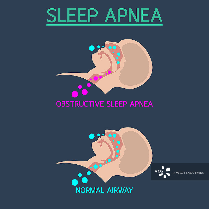 睡眠呼吸暂停图标图片素材