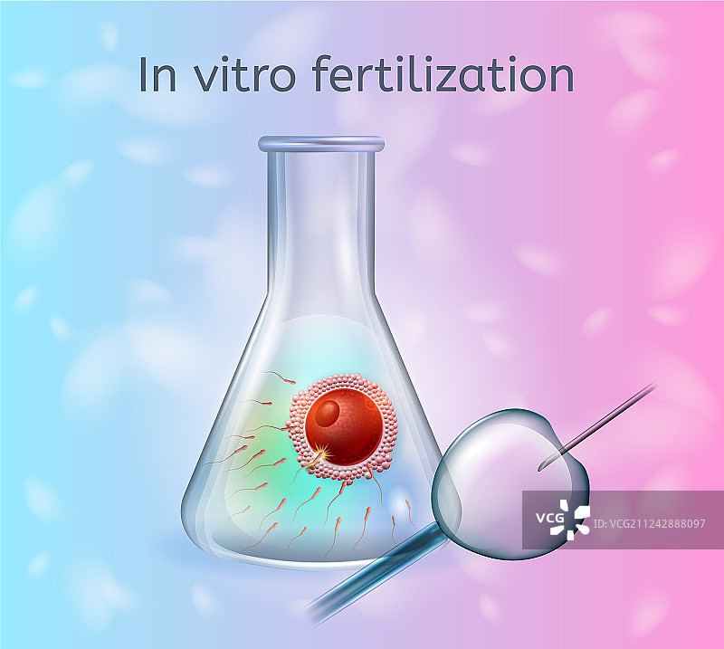 体外受精过程概念图片素材
