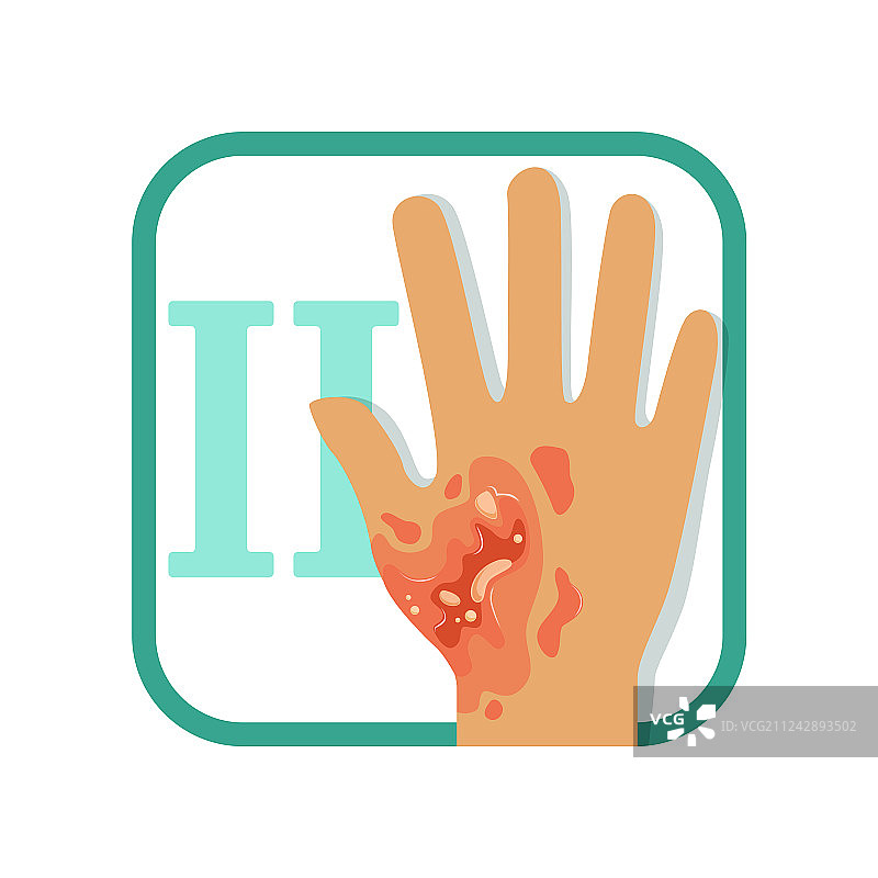 显示二级烧伤红肿的训练卡片图片素材