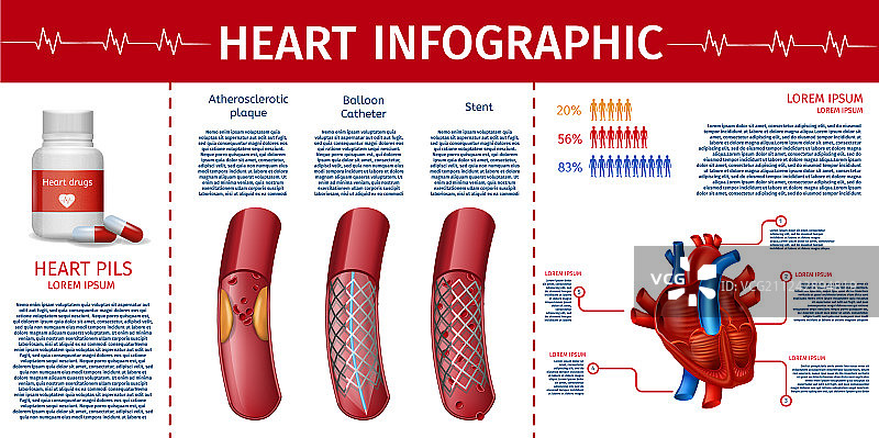 心脏和心血管治疗信息图图片素材