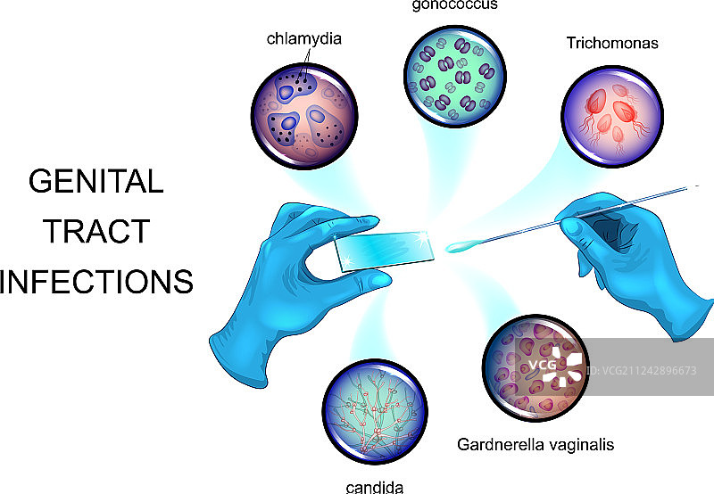 性传播疾病的病原体图片素材