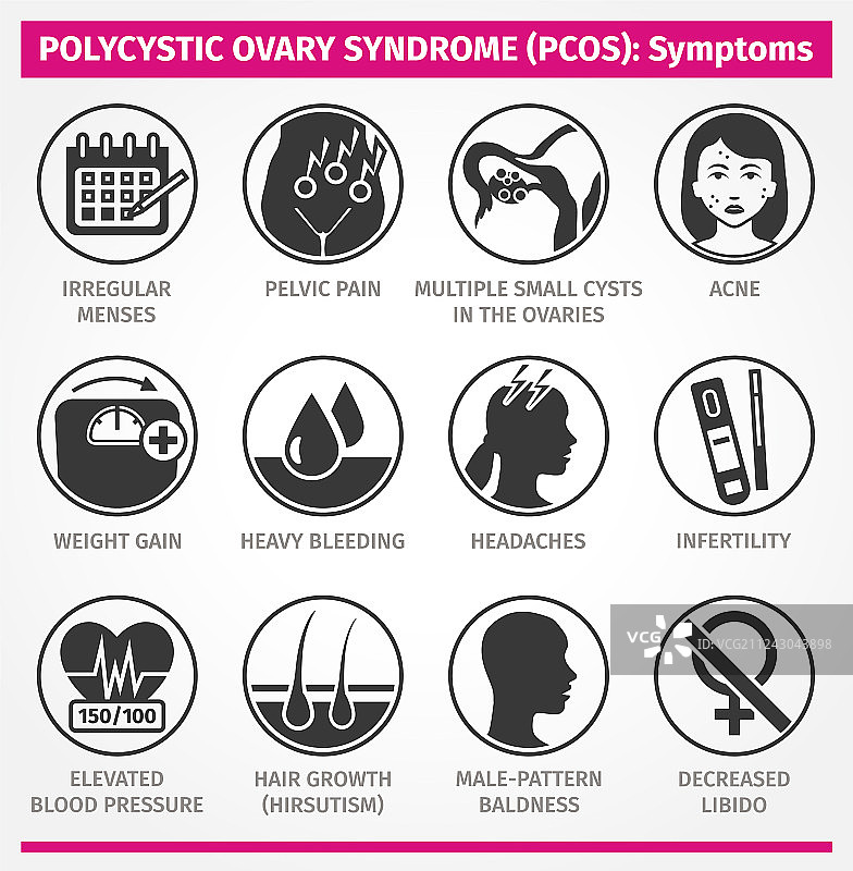 多囊卵巢综合征症状集锦图片素材