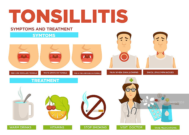 扁桃体炎症状和治疗药物图片素材