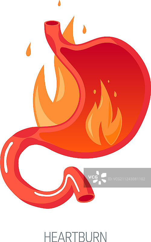 扁平风格的胃食管反流病概念图片素材