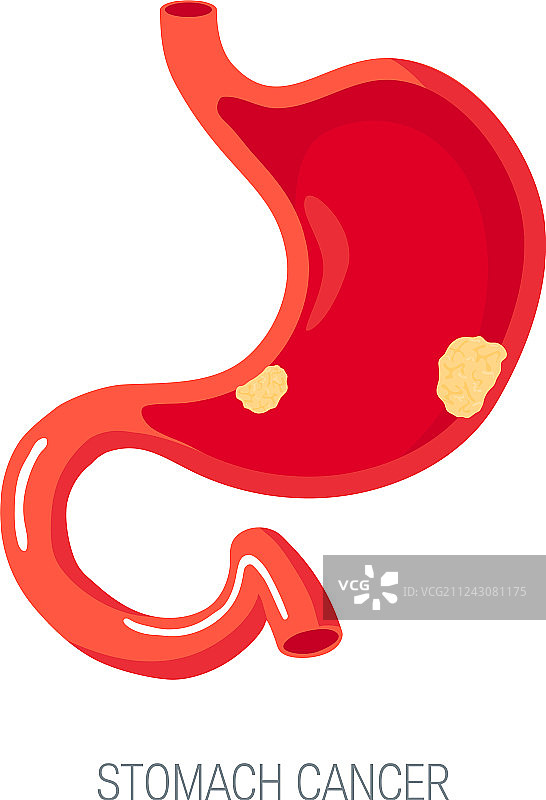 扁平风格的胃癌概念图标图片素材