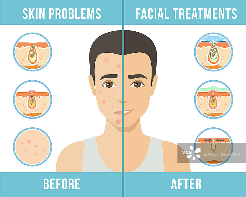 美容程序护肤图片素材