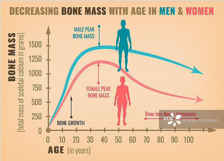 骨量减少图片素材