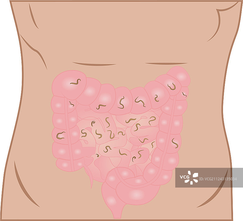 肠道蠕虫图片素材