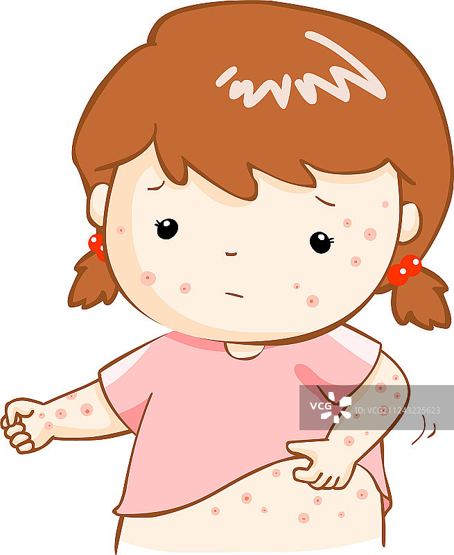 女孩挠身体上发痒的皮疹图片素材