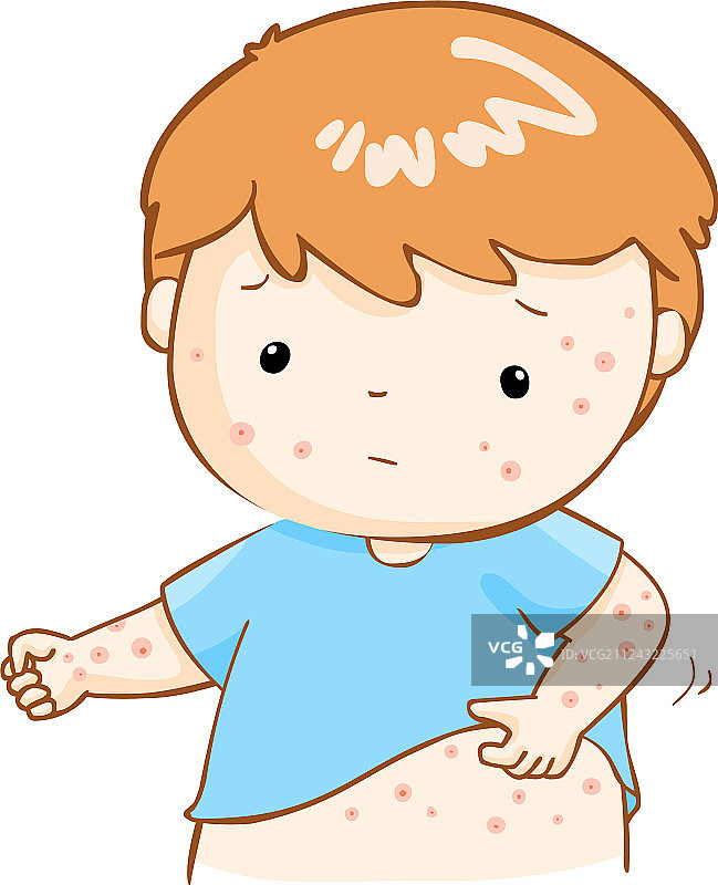男孩在挠身上发痒的疹子图片素材