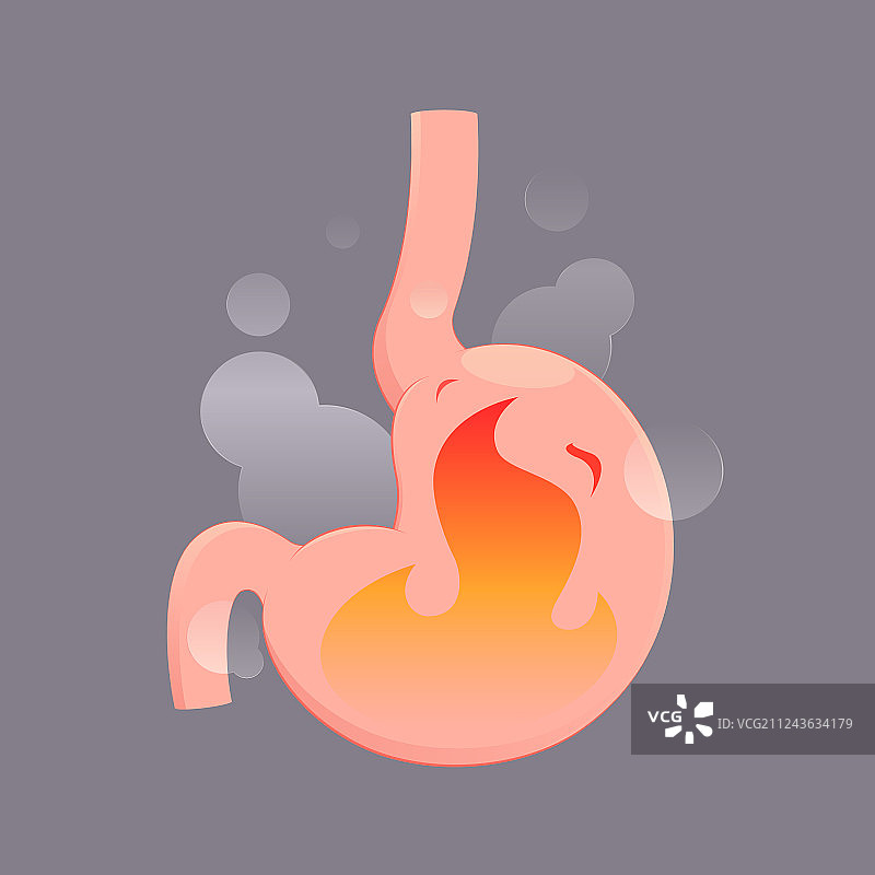 胃酸倒流或胃灼热卡通图片素材