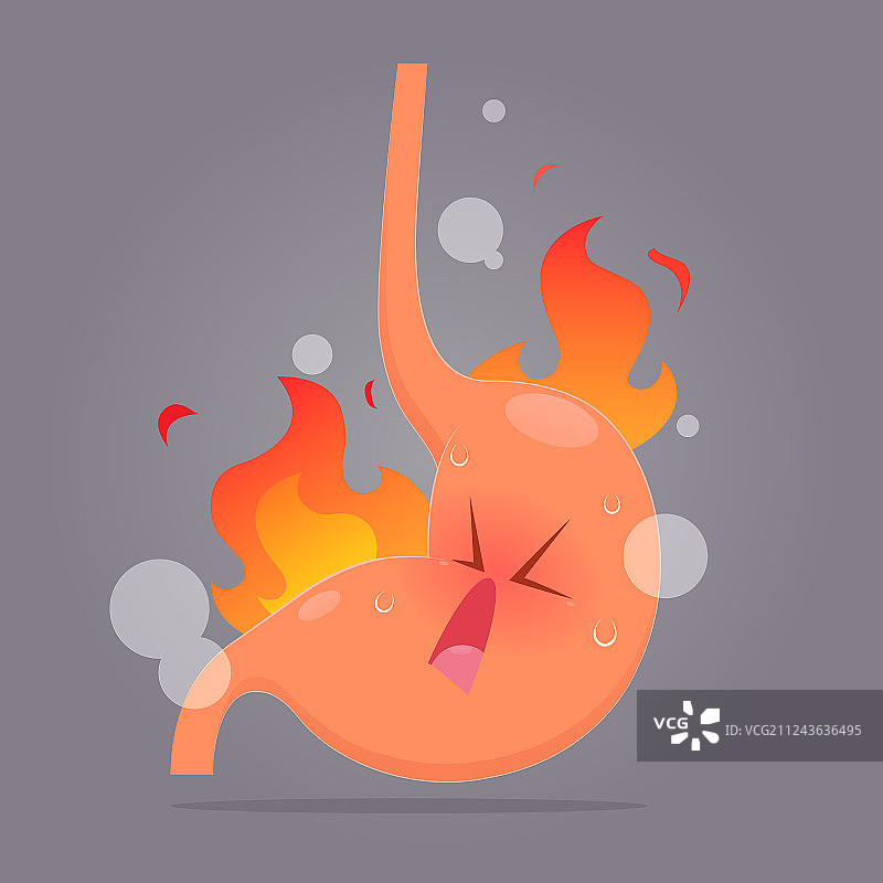 胃酸倒流或胃灼热卡通图片素材