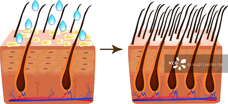 治疗脱发维生素生物素图片素材