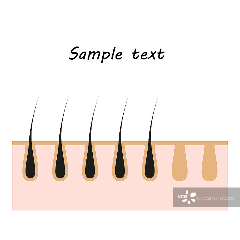 毛发皮肤医用脱毛产品图片素材