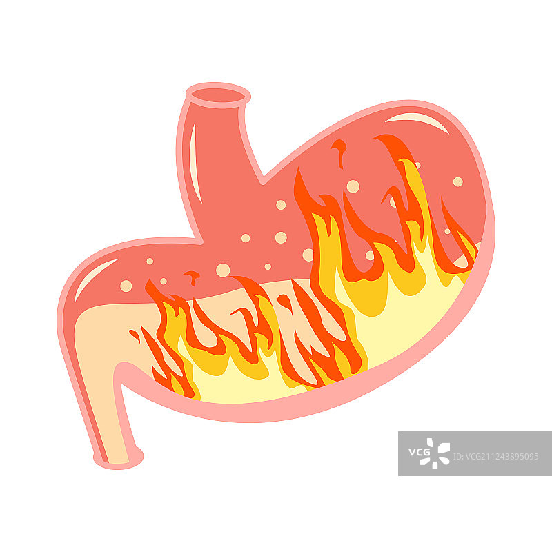 胃灼热医学内部火焰图片素材