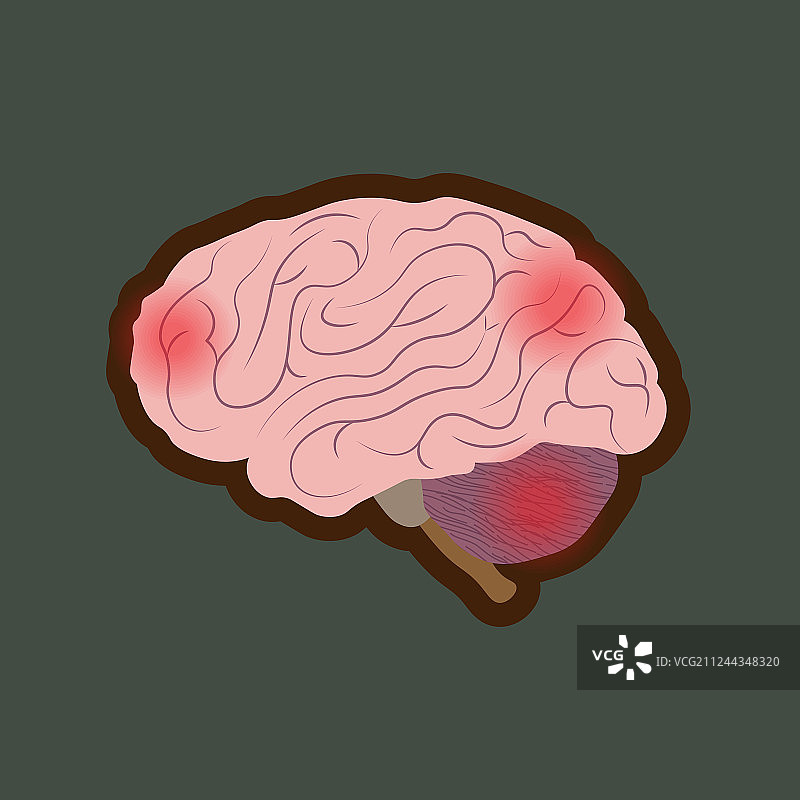大脑疾病疼痛点图片素材