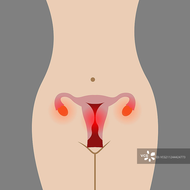 子宫炎症点位图图片素材