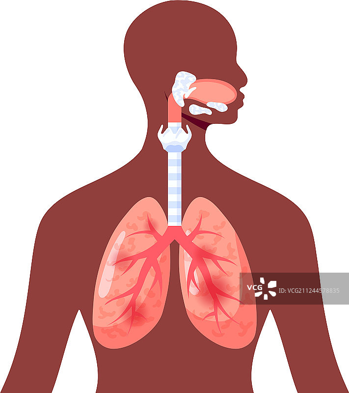 扁平风格的受刺激的肺部图标图片素材