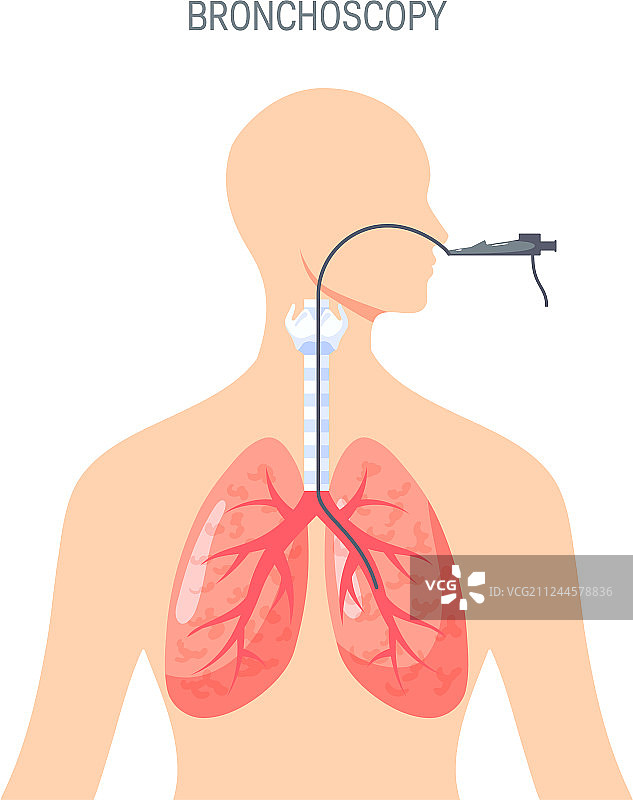 扁平风格的肺部诊断设计图片素材