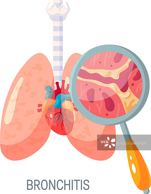 扁平风格的支气管炎疾病图标图片素材