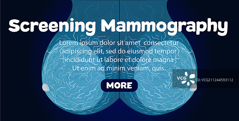 乳腺X光检查banner图片素材