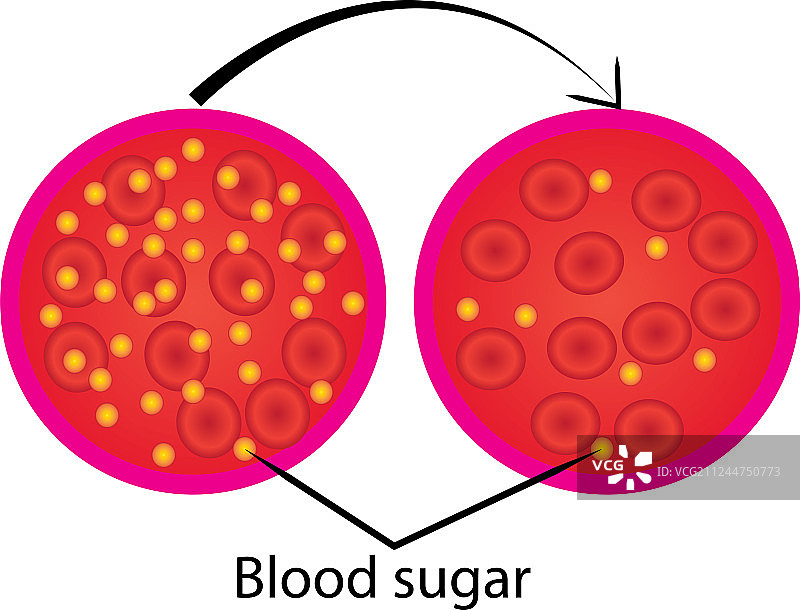 降低血糖控制图片素材