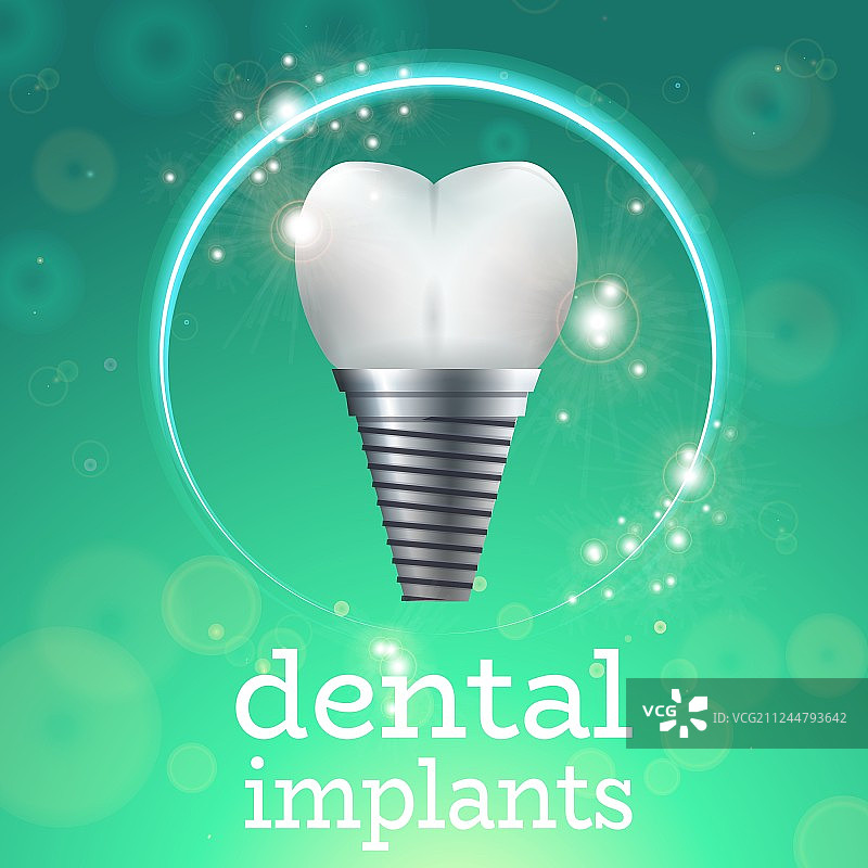 牙科植入体1图片素材
