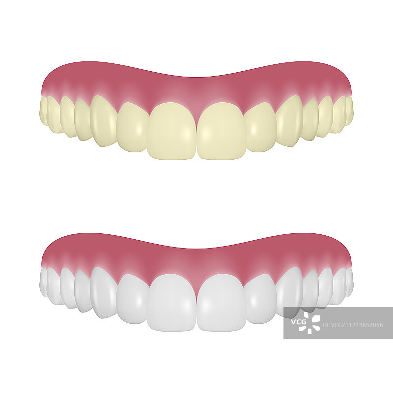 3D逼真渲染义齿套装特写图片素材