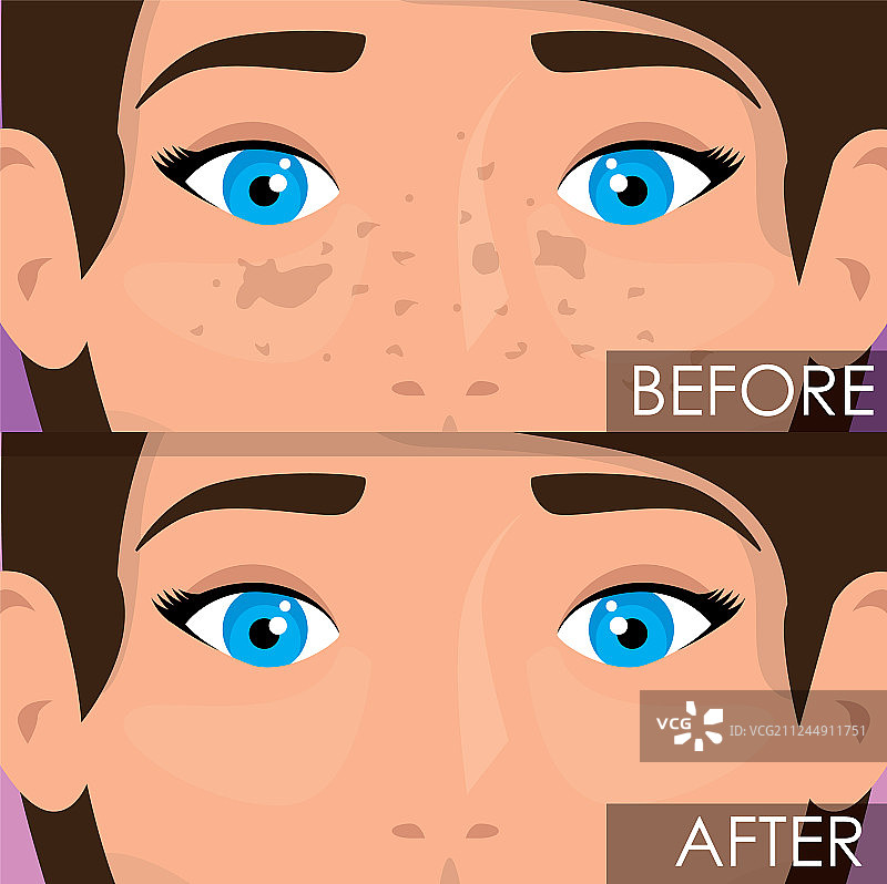 皮肤护理前后的女人图片素材