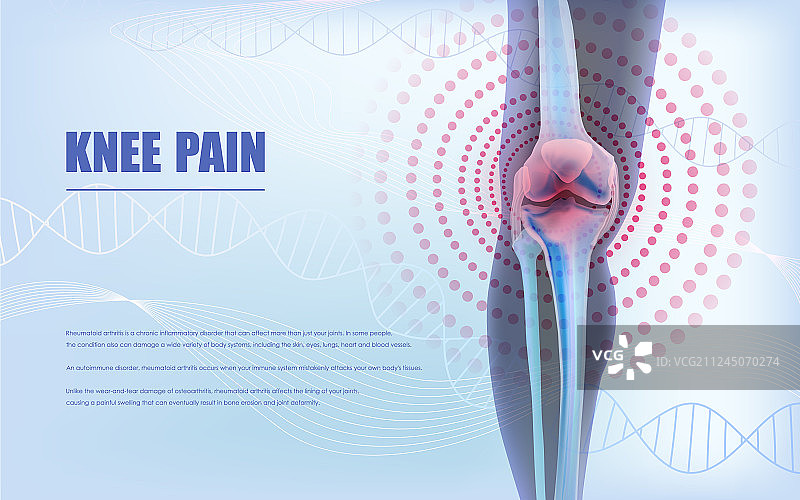 缓解膝盖疼痛图片素材