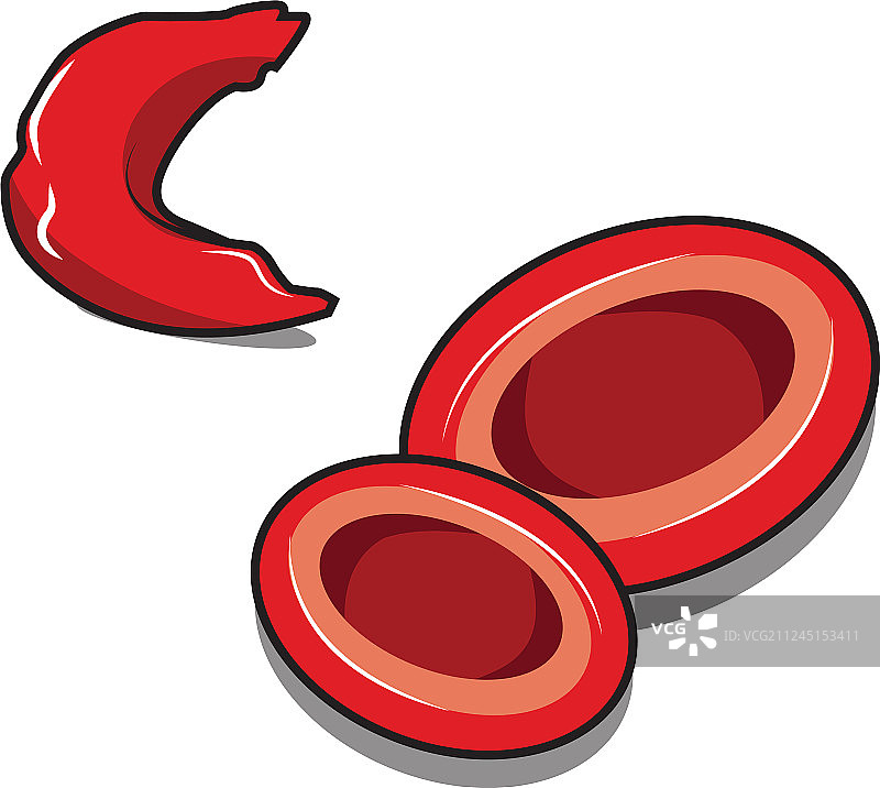 镰状细胞图片素材