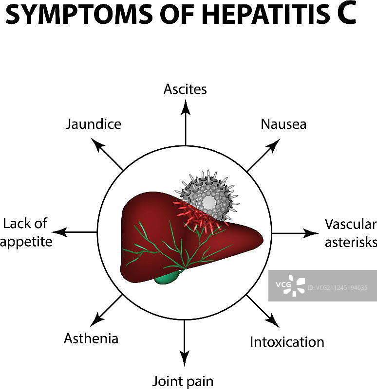 丙型肝炎肝脏世界肝炎症状图片素材