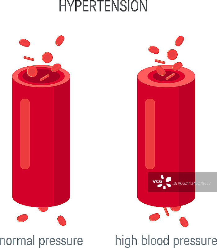 扁平风格的血压概念图片素材