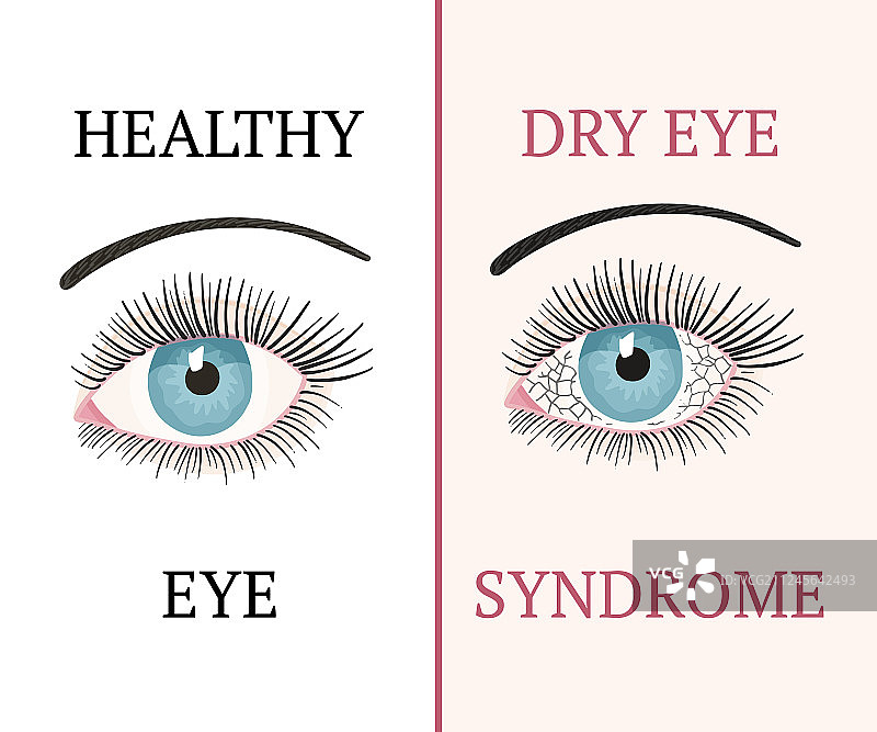 眼科疾病健康图片素材