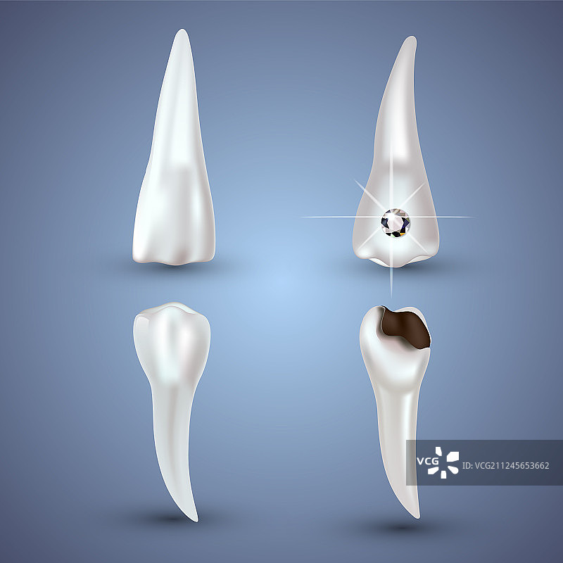 一套3D逼真干净和脏的牙齿模型图片素材