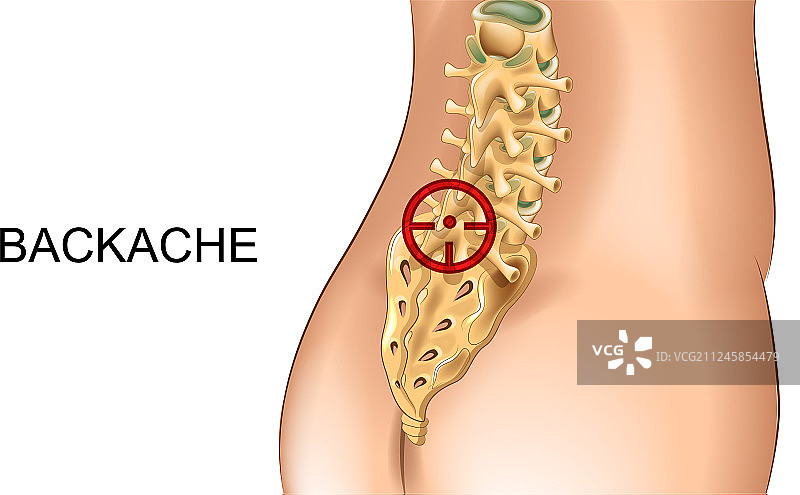 骶骨和腰椎疼痛图片素材