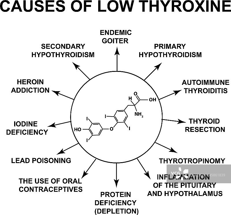 导致甲状腺素偏低图片素材