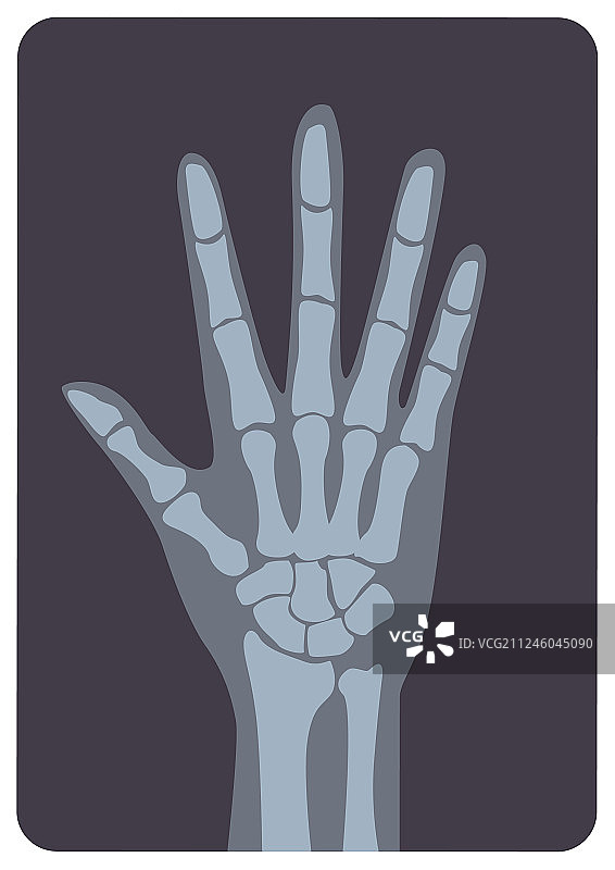 X射线照片或X光图像图片素材