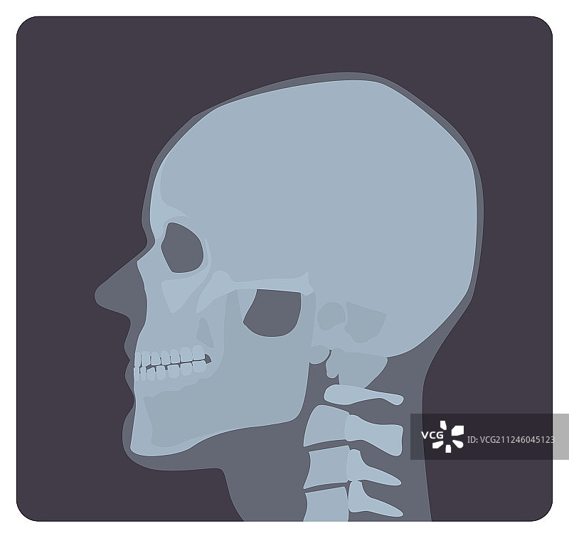 头骨X光片侧位图片素材