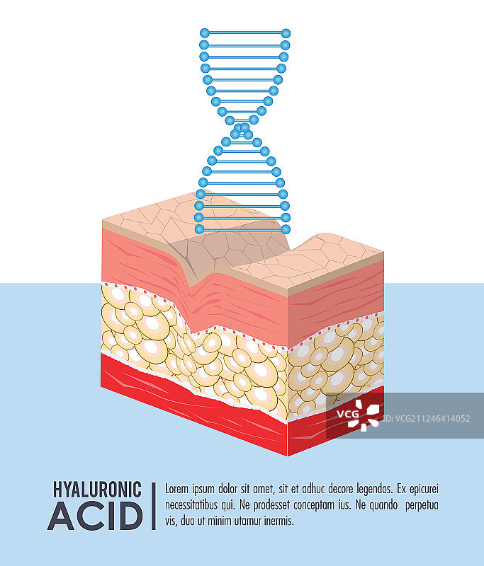 透明质酸填充剂注射信息图图片素材