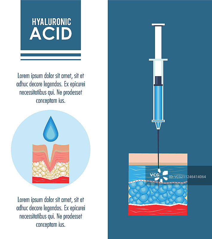 透明质酸填充剂注射信息图图片素材