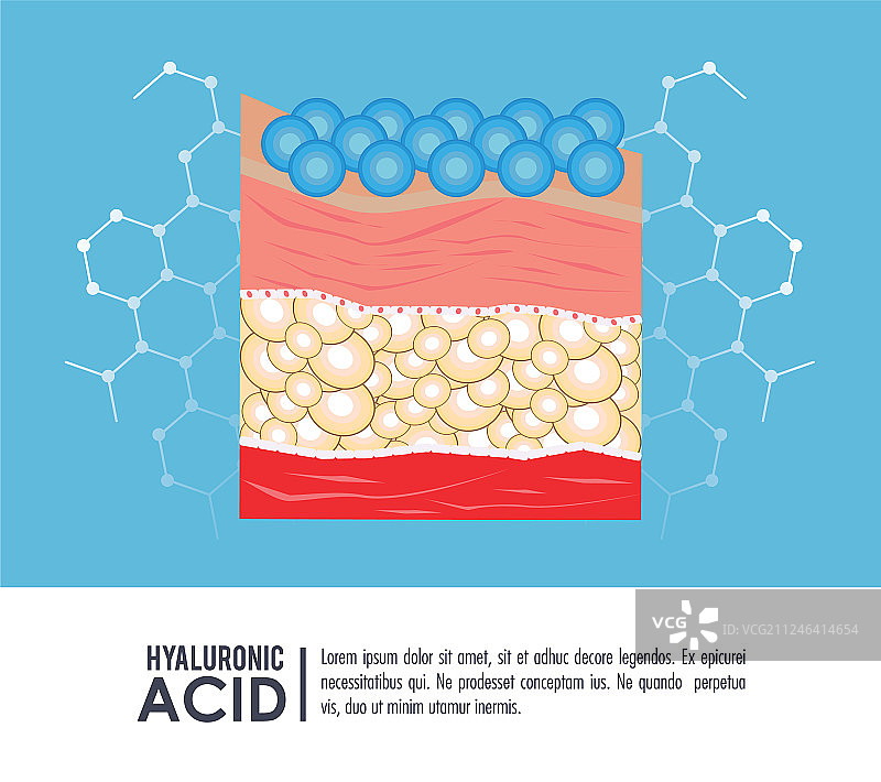 透明质酸填充剂注射信息图图片素材