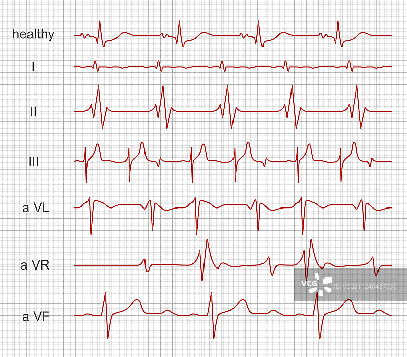 监视器屏幕上的心电图红色心律图片素材