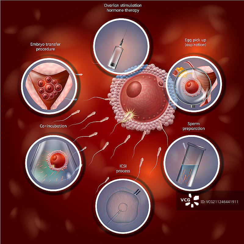在实验室培养皿中手动结合卵子和精子的试管婴儿图片素材